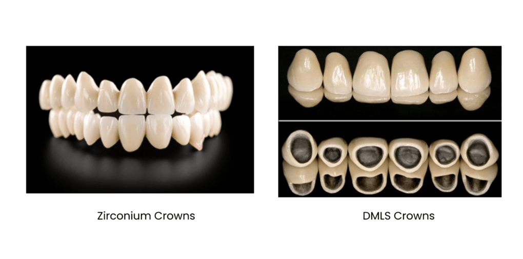 How to Select the Perfect Crown: DMLS or Zirconium